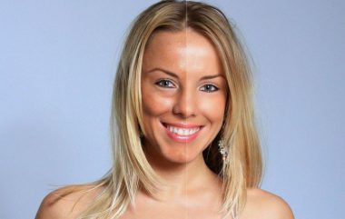 Metody usuwania przebarwień skórnych