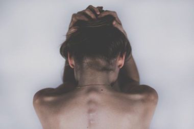 Nadmierne wypadanie włosów a choroby