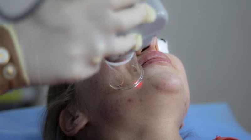 domowe sposoby na przebarwienia skóry