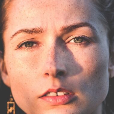 trądziku hormonalnego